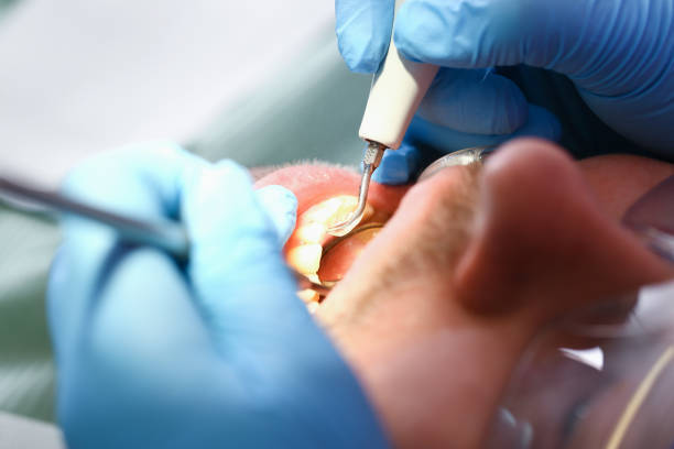 Best Weekend Emergency Dentist in St Louis, MI