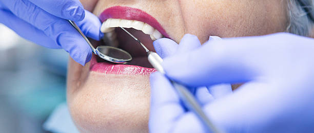 Best Emergency Broken Tooth Repair in St Louis, MI